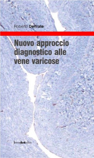 Donne incinte con vene varicose